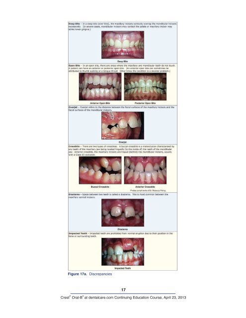 CE 421 - Dental Anatomy: A Review - DentalCare.com