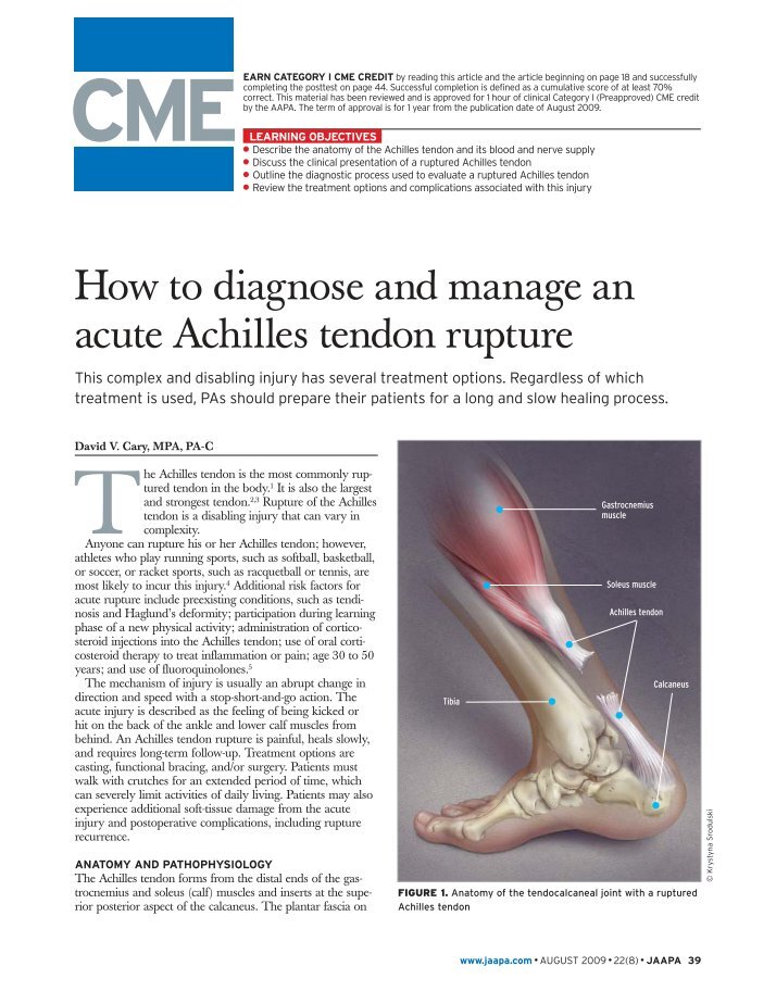 achilles tendon Achilles: achilles, in greek legend, the greatest warrior in the army of agamemnon in the trojan war. achilles tendon Achilles: achilles, in greek legend, the greatest warrior in the army of agamemnon in the trojan war.
