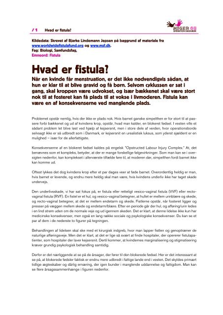 Hvad er fistula?