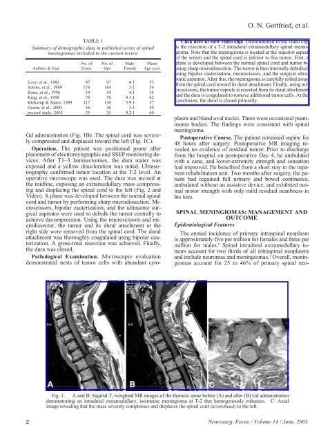 Spinal meningiomas: surgical management and outcome