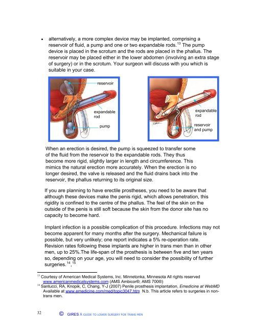 A guide to lower surgery for trans men - Gender Identity Research ...