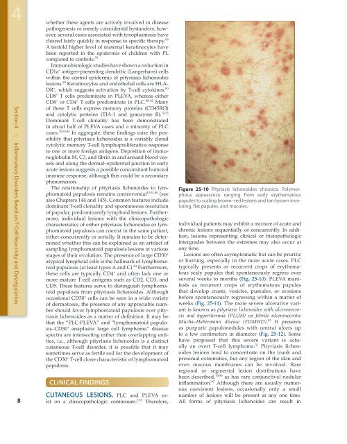 Chapter 25 :: Parapsoriasis and Pityriasis Lichenoides :: Gary S ...