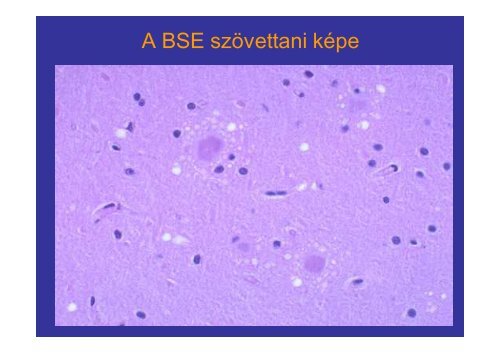 Prion betegségek - Semmelweis Egyetem, Orvosi Mikrobiológiai ...