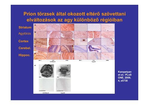 Prion betegségek - Semmelweis Egyetem, Orvosi Mikrobiológiai ...