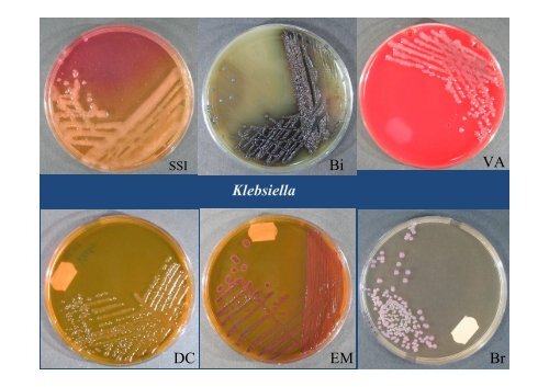 Gram-negative facultative anaerobic rods