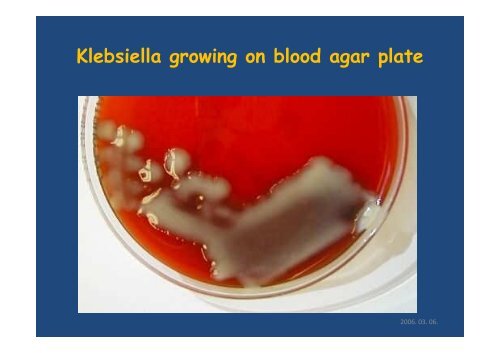 Gram-negative facultative anaerobic rods