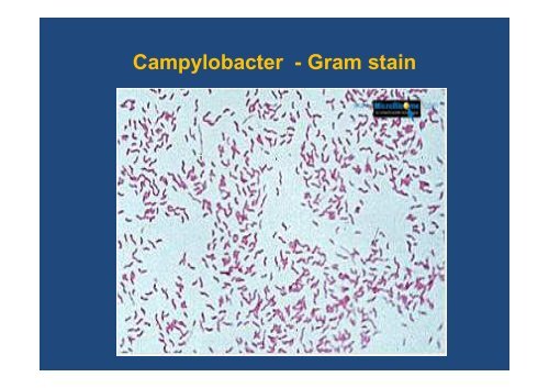 Gram-negative facultative anaerobic rods