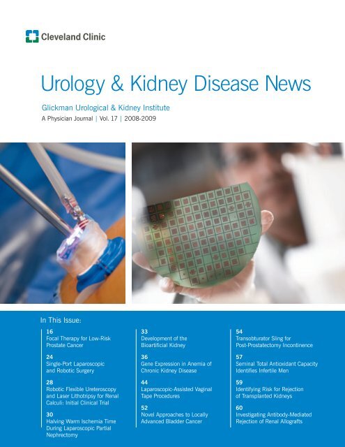 Urology & Kidney Disease News - Cleveland Clinic