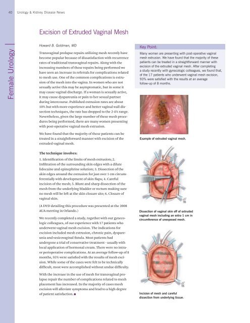 Urology & Kidney Disease News - Cleveland Clinic