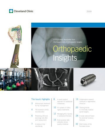 Orthopaedic Insights - Cleveland Clinic