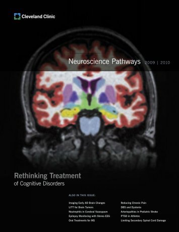 Neuroscience Pathways 2009 | 2010 Rethinking ... - Cleveland Clinic