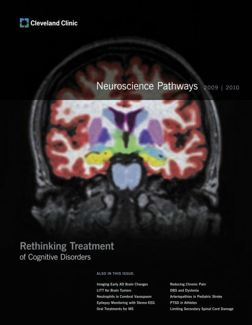 https://img.yumpu.com/18002597/1/500x640/neuroscience-pathways-2009-2010-rethinking-cleveland-clinic.jpg