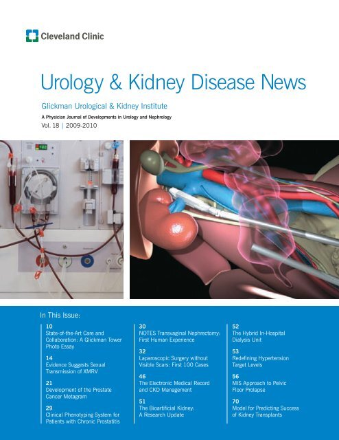 Urology & Kidney Disease News Fall 2009 - Cleveland Clinic