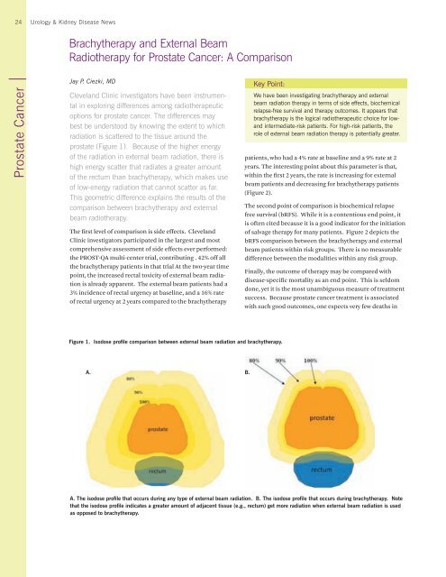 Urology & Kidney Disease News Fall 2009 - Cleveland Clinic