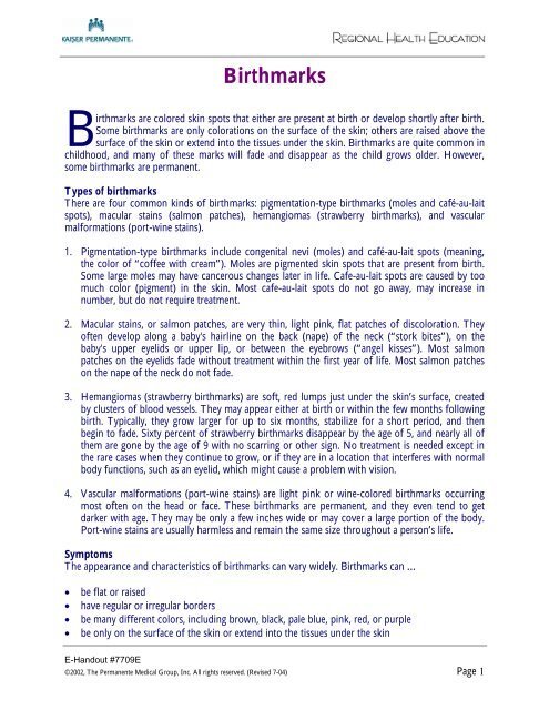 Birthmarks My Doctor Online The Permanente Medical Group