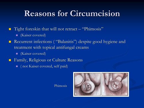 Circumcision