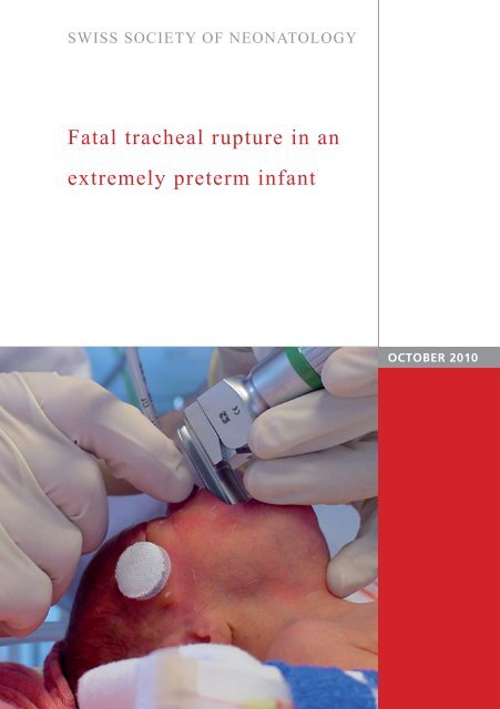 Fatal tracheal rupture in an extremely preterm infant - Swiss Society ...