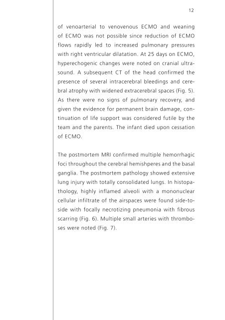 Fatal pertussis infection - Swiss Society of Neonatology