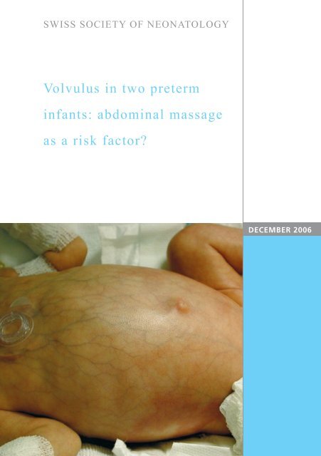 Volvulus in two preterm infants: abdominal massage as a risk factor?