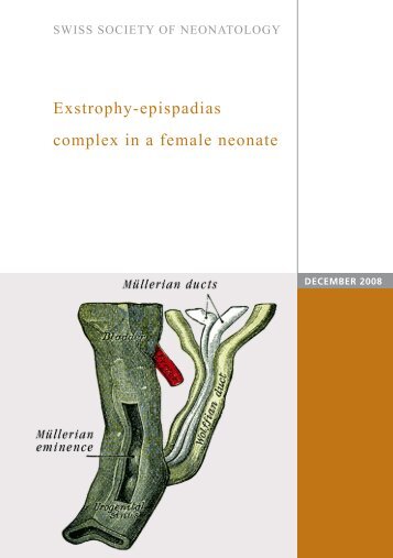 Exstrophy-epispadias complex in a female neonate - Swiss Society ...