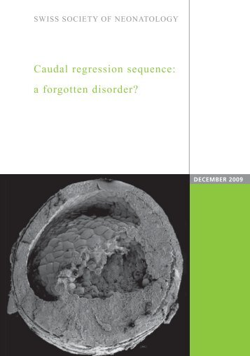 Caudal regression sequence: a forgotten disorder? - Swiss Society ...