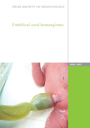 Umbilical cord hemangioma - Swiss Society of Neonatology