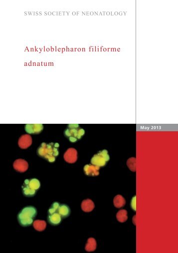 Ankyloblepharon filiforme adnatum - Swiss Society of Neonatology