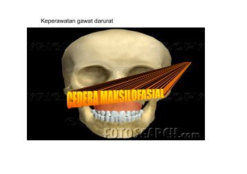 Trauma Maksilofasial - Fakultas Keperawatan - Unair