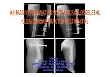 askep fraktur - Fakultas Keperawatan - Unair