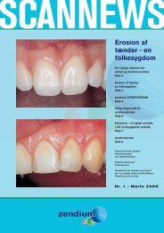 Erosion af tænder - en folkesygdom - Opus Health Care