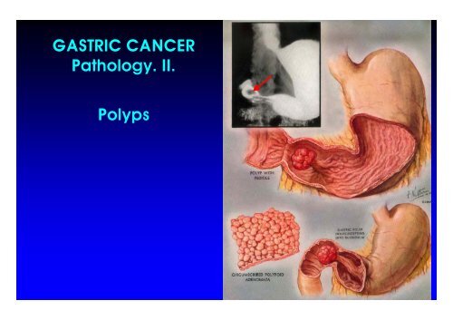 AA. Gastric C I 06. ppt - Università degli studi di Pavia