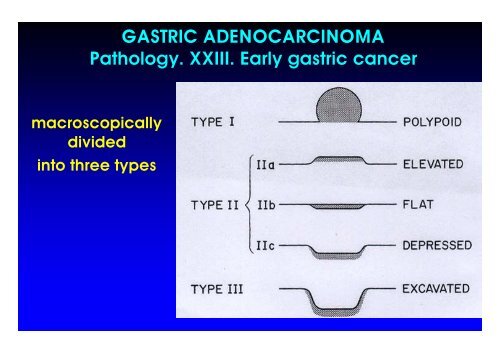 AA. Gastric C I 06. ppt - Università degli studi di Pavia