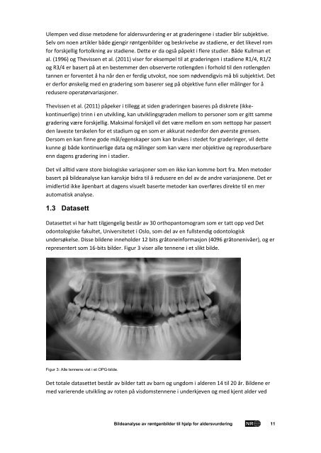 Bildeanalyse av røntgenbilder til hjelp for aldersvurdering - Norsk ...