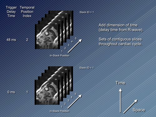 New Enhanced Multi-frame DICOM CT and MR ... - Dicom - NEMA