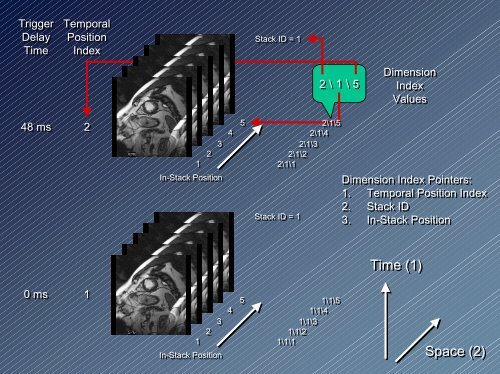 New Enhanced Multi-frame DICOM CT and MR ... - Dicom - NEMA