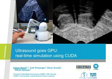 Ultrasound goes GPU: real-time simulation using CUDA - Chair for ...