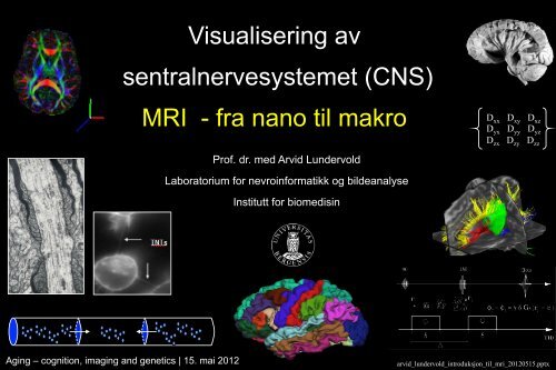 Arvid Lundervold: Introduksjon til MRI