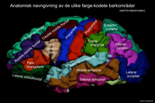 Arvid Lundervold: Introduksjon til MRI