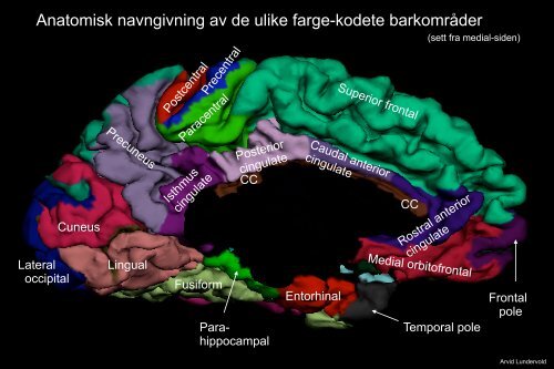Arvid Lundervold: Introduksjon til MRI