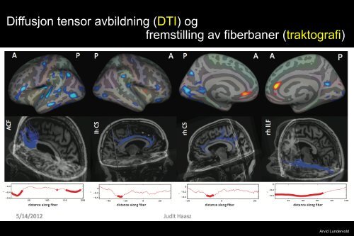 Arvid Lundervold: Introduksjon til MRI