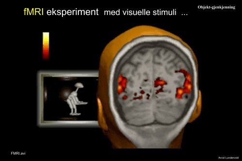 Arvid Lundervold: Introduksjon til MRI