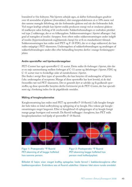 PET-CENTRETS ÅRSRAPPORT 2008 - Aarhus Universitetshospital