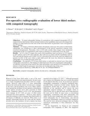 Pre-operative radiographic evaluation of lower third molars with ...