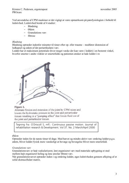 CPM = Continius Passive Motion Kontinuerlig passiv bevægelse ...