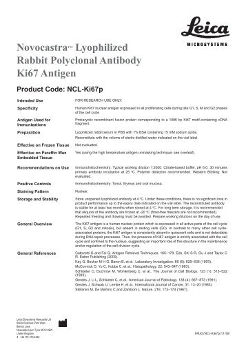 Novocastratm Lyophilized Rabbit Polyclonal Antibody Ki67 Antigen