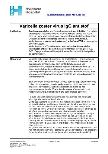 Varicella zooster virus antistof