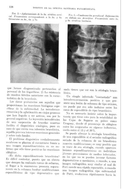 ASPECTOS EPIDEMIOLOGICOS Y CLINICOS DE LA ... - PAHO/WHO