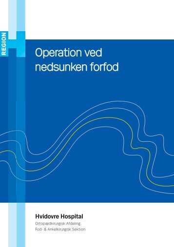 Operation ved nedsunken forfod