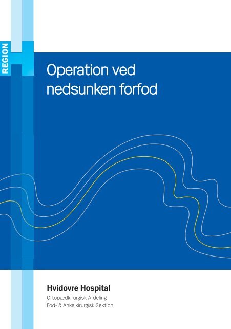 Operation ved nedsunken forfod