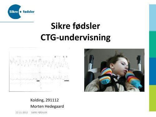 Sikre fødsler CTG-undervisning